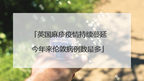 英国麻疹疫情持续蔓延 今年来伦敦病例数最多